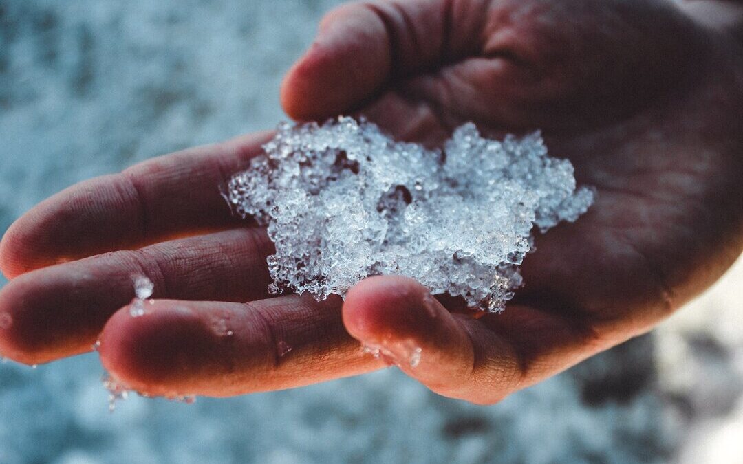 The Right Way to Take Care of Your Skin in Winter